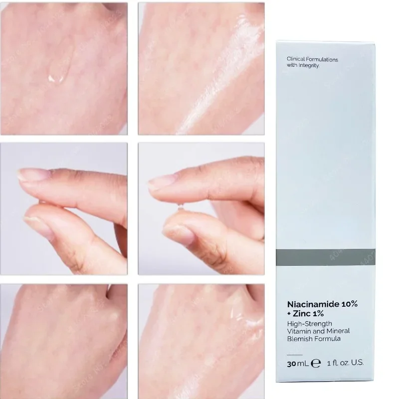 Niacinamide magnesium whitenin - Alpha Lipoic Cream recensie en prijs