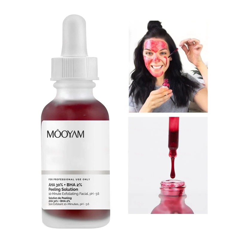 AHA 30%+BHA 2% Huidverzorging  - Alpha Lipoic Cream recensie en prijs